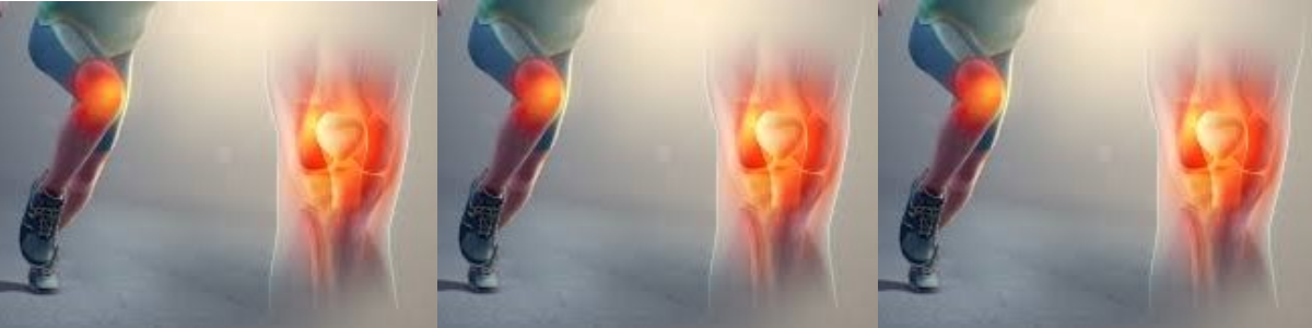 Understanding Lower Limb Injuries